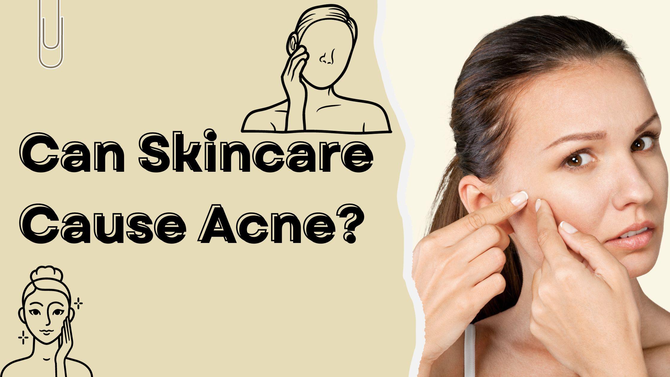 skincare cause acne