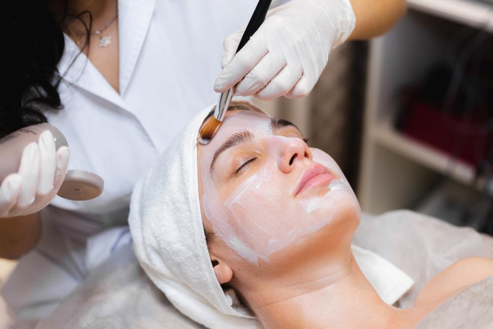 Chemical peels for acne 