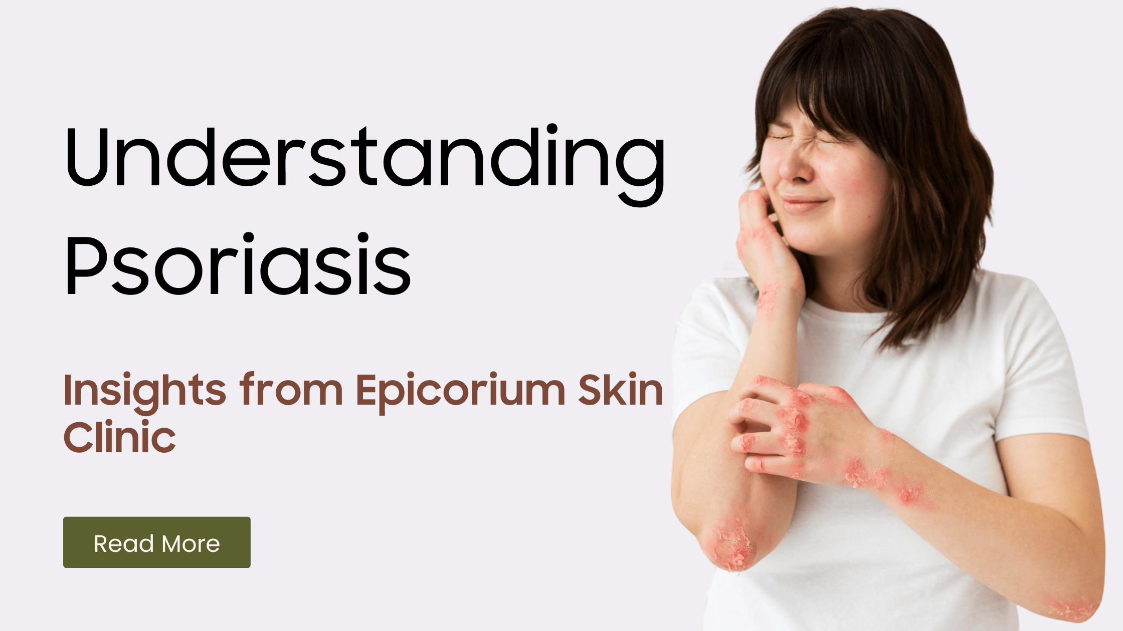 Psoriasis Explained