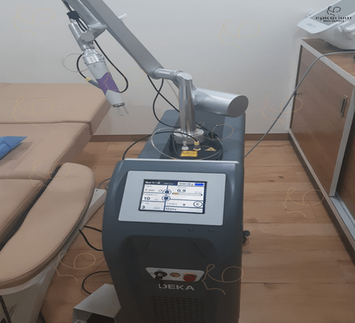 best carbon laser peel in hsr