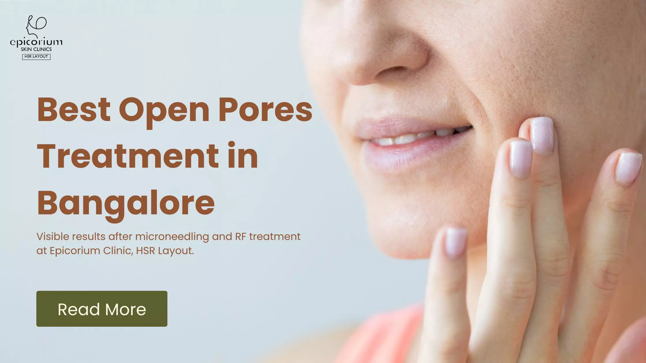 Best Open Pores Treatment in Bangalore