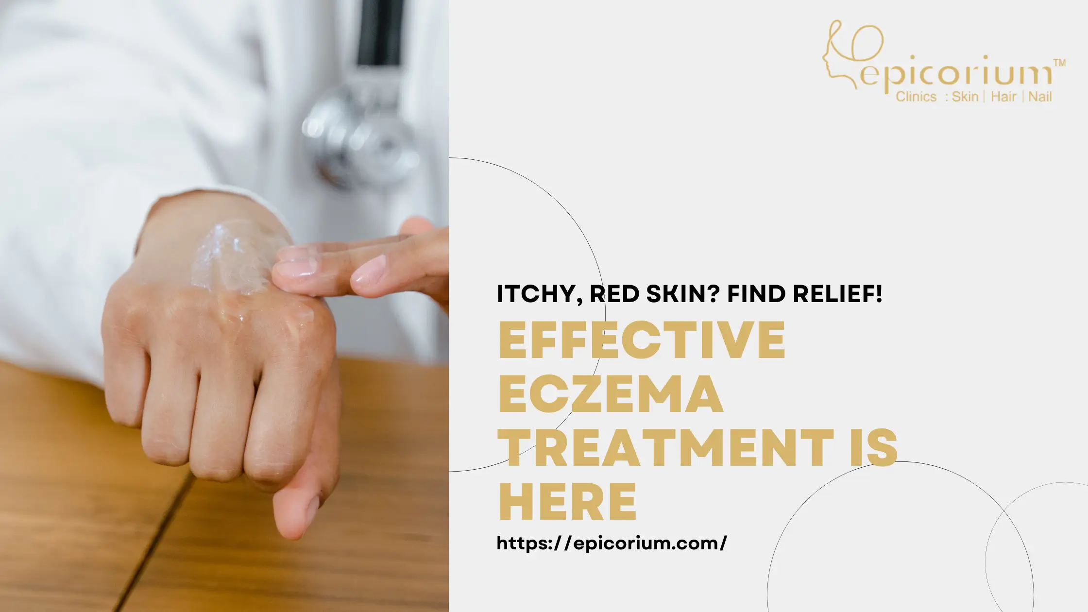 Eczema Treatment